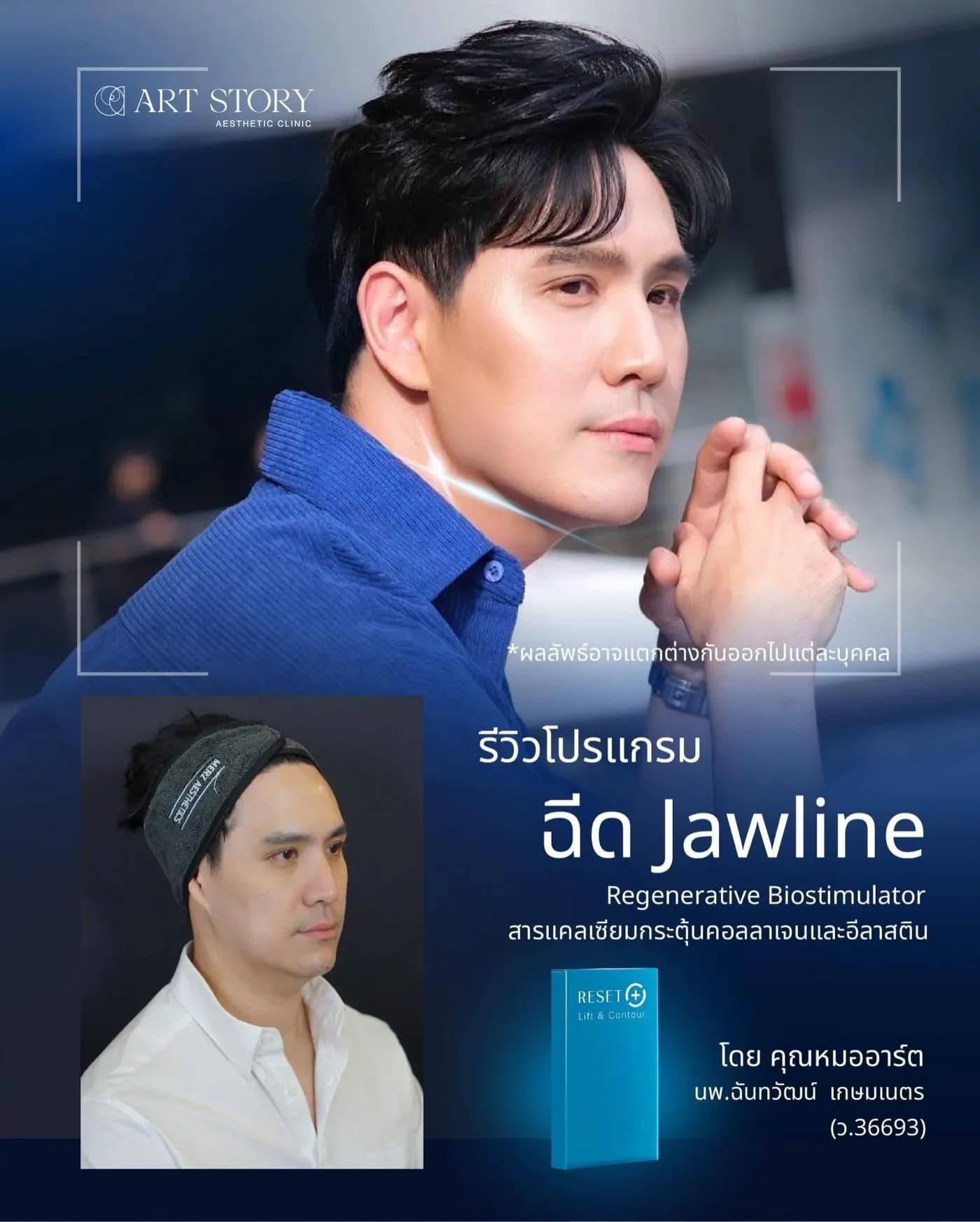 โปรแกรมฟื้นฟูคุณภาพผิว ปรับกรอบหน้าบริเวณ Jawline — ภาพก่อนและหลังรับบริการ